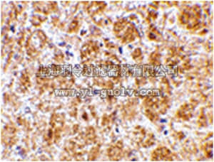 merck millipore,默克密理博,ABN495,Anti-DARC Antibody