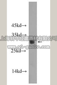 merck millipore,默克密理博,ABN496,Anti-SRY Antibody