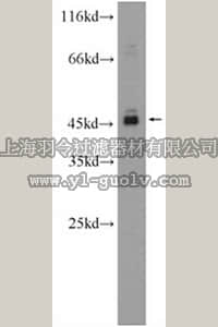 merck millipore,默克密理博,ABN517,Anti-AIM2 Antibody
