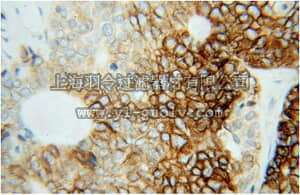 merck millipore,默克密理博,ABN521,Anti-CA9 Antibody