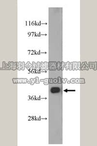 merck millipore,默克密理博,ABN526,Anti-FAH Antibody