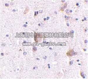 merck millipore,默克密理博,ABN645,Anti-RIM 2 Antibody merck millipore,默克密理博,ABN645,Anti-RIM 2 Antibody