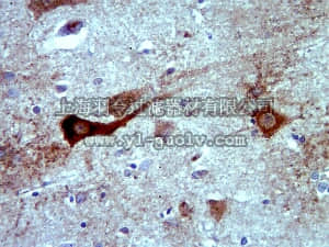merck millipore,默克密理博,ABN64,Anti-RYK Antibody