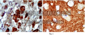 merck millipore,默克密理博,ABN66,Anti-Cholesterol acyltransferase 1 Antibody