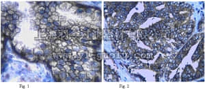 merck millipore,默克密理博,ABN73,Anti-Neutral amino acid transporter (ASCT2) Antibody