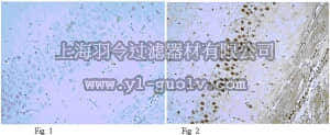 merck millipore,默克密理博,ABN88,Anti-phospho-NR1 (Ser896) Antibody