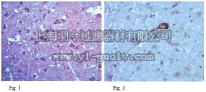 merck millipore,默克密理博,ABN96,Anti-Neurexin3 Antibody