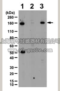 merck millipore,默克密理博,ABS219,Anti-phospho-Tie2 (Ser1119) Antibody