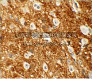 merck millipore,默克密理博,ABS436,Anti-ROCK2 Antibody