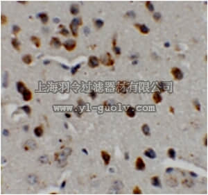 merck millipore,默克密理博,ABS453,Anti-CHD7 Antibody