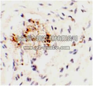 merck millipore,默克密理博,ABS460,Anti-LEMD3 Antibody