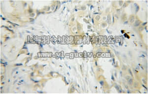 merck millipore,默克密理博,ABS476,Anti-PLEK Antibody