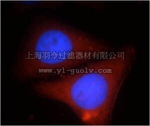merck millipore,默克密理博,ABS477,Anti-LBP Antibody