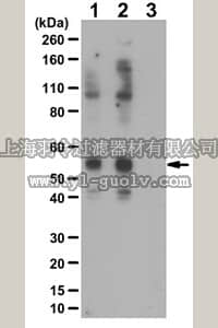 merck millipore,默克密理博,ABS485,Anti-phospho LEF Antibody (Thr155)