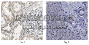 merck millipore,默克密理博,ABS487,Anti-LARS Antibody