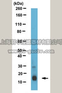 merck millipore,默克密理博,ABS538,Anti-FABP1 Antibody