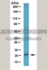 merck millipore,默克密理博,ABS568,Anti-RBP4 Antibody