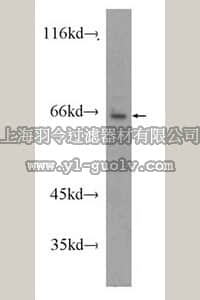 merck millipore,默克密理博,ABS581,Anti-SLC11A2 Antibody
