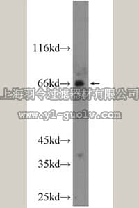 merck millipore,默克密理博,ABS596,Anti-TSHR Antibody