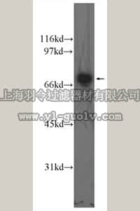 merck millipore,默克密理博,ABS598,Anti-DLAT Antibody