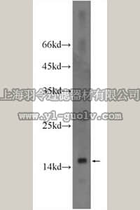 merck millipore,默克密理博,ABS605,Anti-FABP2 Antibody
