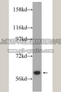 merck millipore,默克密理博,ABS611,Anti-ABCB10 Antibody