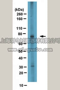 merck millipore,默克密理博,ABS65,Anti-CPT1A Antibody