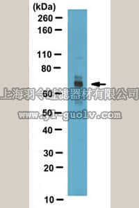 merck millipore,默克密理博,ABS85,Anti-CPT2 Antibody