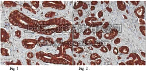 merck millipore,默克密理博,ABT112,Anti-Lysyl Oxidase (LOX) Antibody