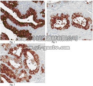 merck millipore,默克密理博,ABT113,Anti-LPA receptor 3 (Edg-7) Antibody