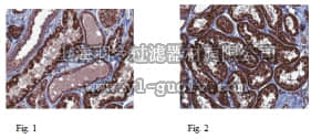 merck millipore,默克密理博,ABT128,Anti-Polycystin-1 Antibody