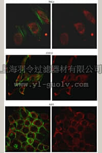 merck millipore,默克密理博,ABT132,Anti-Profilin-1 Antibody