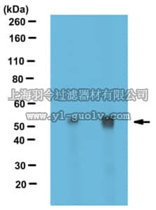 merck millipore,默克密理博,ABT170,Anti-alpha Tubulin Antibody, nontyrosinated