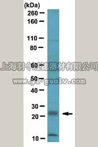 merck millipore,默克密理博,ABT17,Anti-RGS4 Antibody
