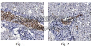 merck millipore,默克密理博,ABT185,Anti-Spectrin beta chain Antibody, erythrocyte