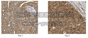merck millipore,默克密理博,ABT187,Anti-TRPM8 Antibody