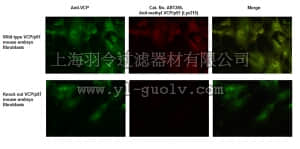 merck millipore,默克密理博,ABT286,Anti-methyl VCP/p97 Antibody (Lys315)