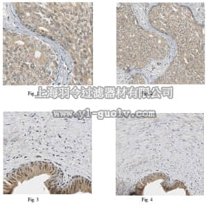 merck millipore,默克密理博,ABT289,Anti-MMP-10 Antibody