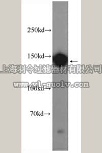 merck millipore,默克密理博,ABT290,Anti-DSG2 Antibody