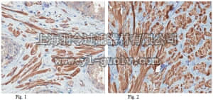 merck millipore,默克密理博,ABT293,Anti-MYH11 Antibody