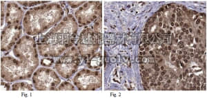 merck millipore,默克密理博,ABT294,Anti-ZMPSTE24 Antibody
