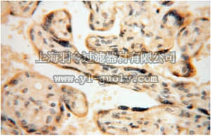 merck millipore,默克密理博,ABT296,Anti-TOMM40 Antibody