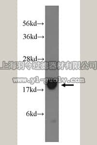 merck millipore,默克密理博,ABT299,Anti-MYLPF Antibody