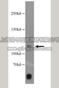 merck millipore,默克密理博,ABT303,Anti-PITRM1 Antibody