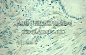 merck millipore,默克密理博,ABT304,Anti-TAGLN Antibody