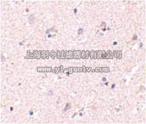 merck millipore,默克密理博,ABT337,Anti-NANOS1 Antibody