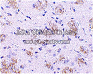 merck millipore,默克密理博,ABT341,Anti-KLHL1 Antibody