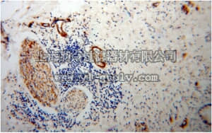 merck millipore,默克密理博,ABT345,Anti-AMPH Antibody