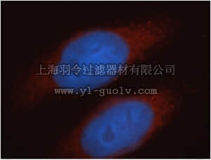 merck millipore,默克密理博,ABT348,Anti-AGBL2 Antibody