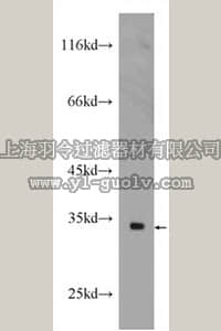 merck millipore,默克密理博,ABT359,Anti-NAPA Antibody